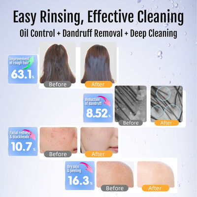 Générateur de bulles ultra fines avec une taille de bulles de 0,1 à 50 microns pour un retrait de 300 % des résidus de pesticides et un nettoyage en profondeur des pores de 100 millions de bulles/ml